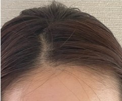 女性の治療事例2 初診時
